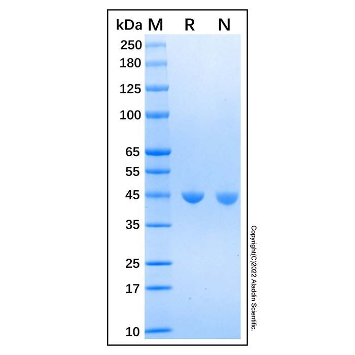 Recombinant Human Adenosylhomocysteinease/AHCY Protein