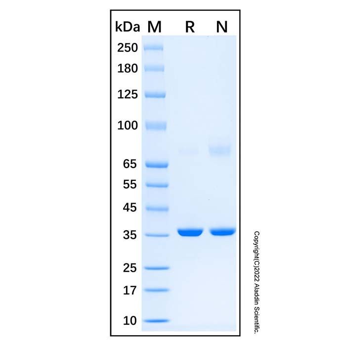 Recombinant Human PCTAIRE1 Protein
