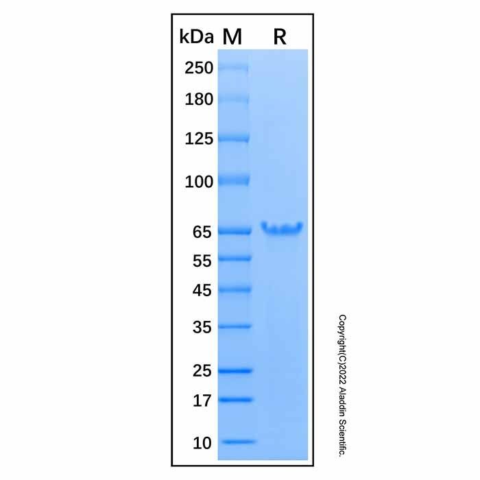 Recombinant Human Exosome Component 9 Protein
