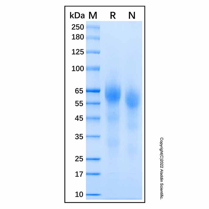 Recombinant Human PSAP Protein