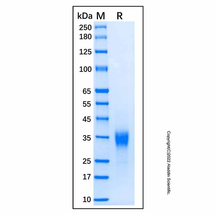 Recombinant Human CGB3/CGB5 Protein