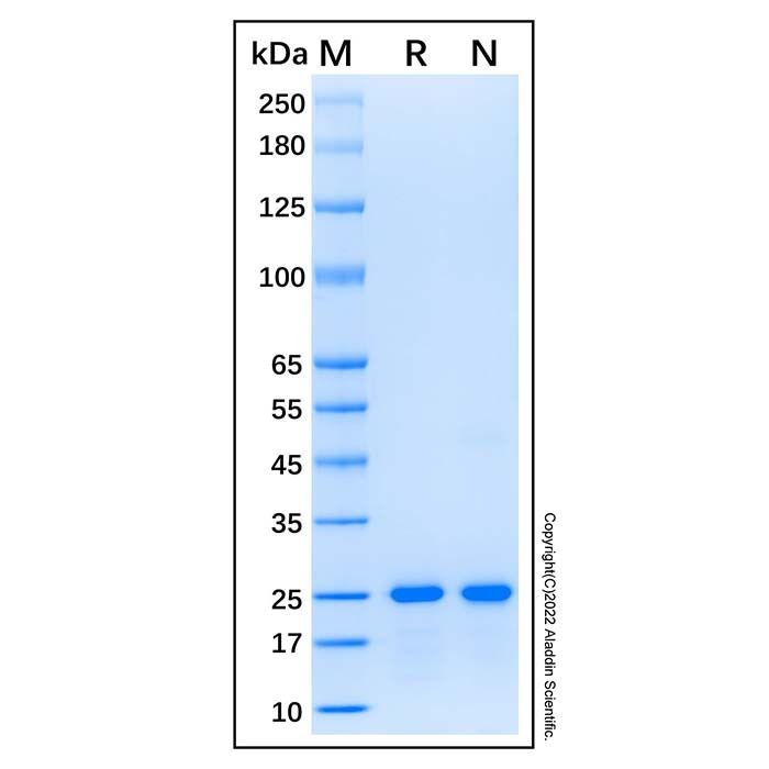Recombinant Human CBX1/HP1 beta Protein