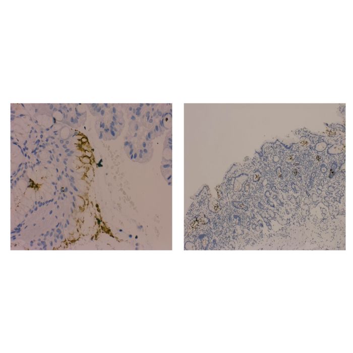 Recombinant Helicobacter pylori Antibody