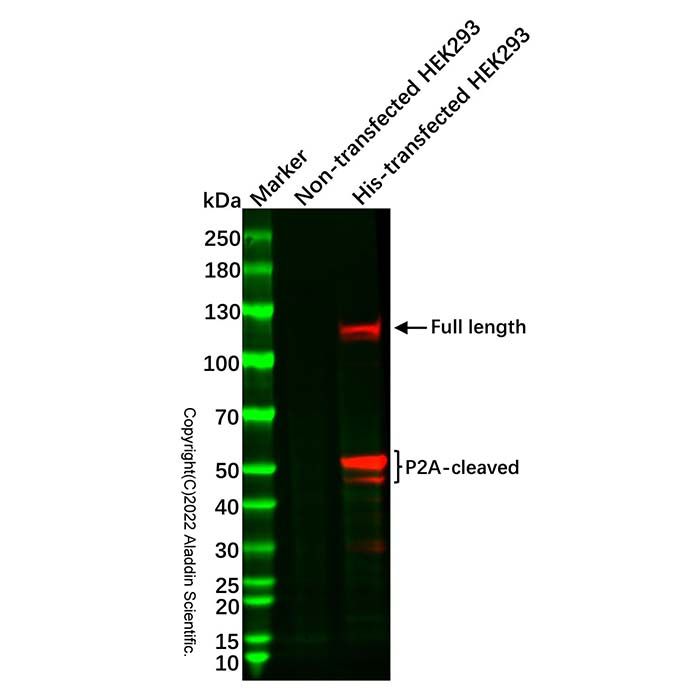 Recombinant His tag Antibody