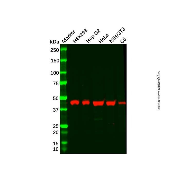 Recombinant ACAA2 Antibody