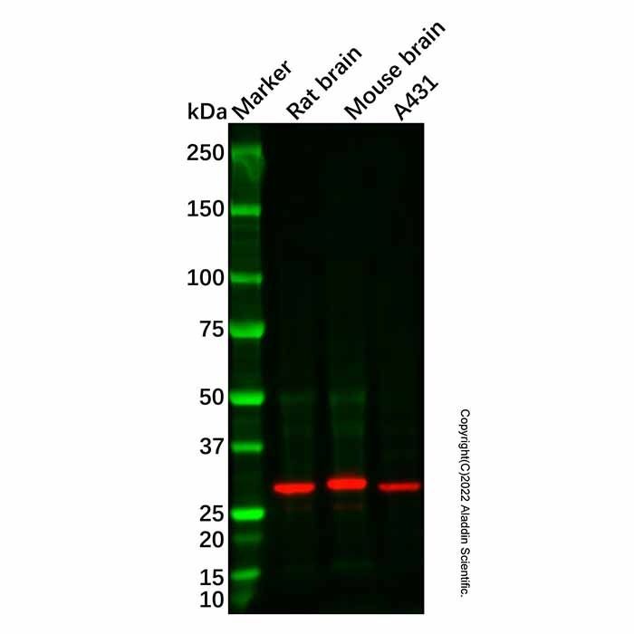 Recombinant Carbonic anhydrase 2/CA2 Antibody