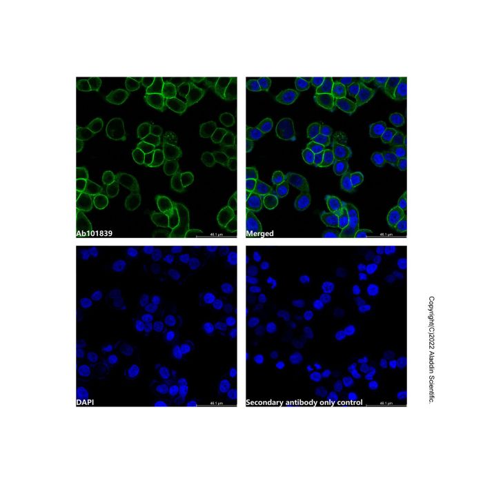 Recombinant EpCAM Antibody