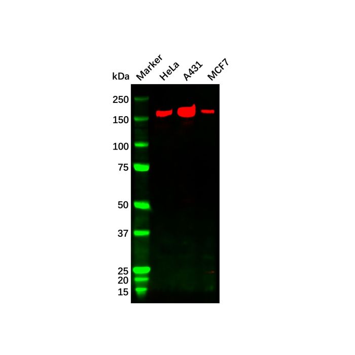 ErbB2/Her2 Mouse mAb
