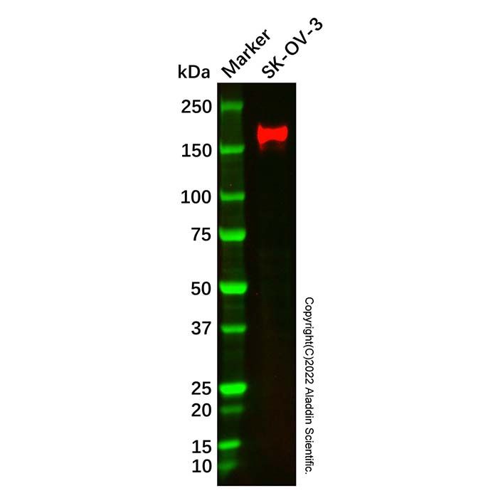 ErbB2/Her2 Mouse mAb