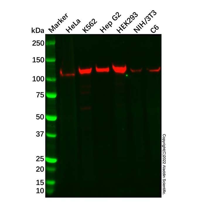 Recombinant GART Antibody