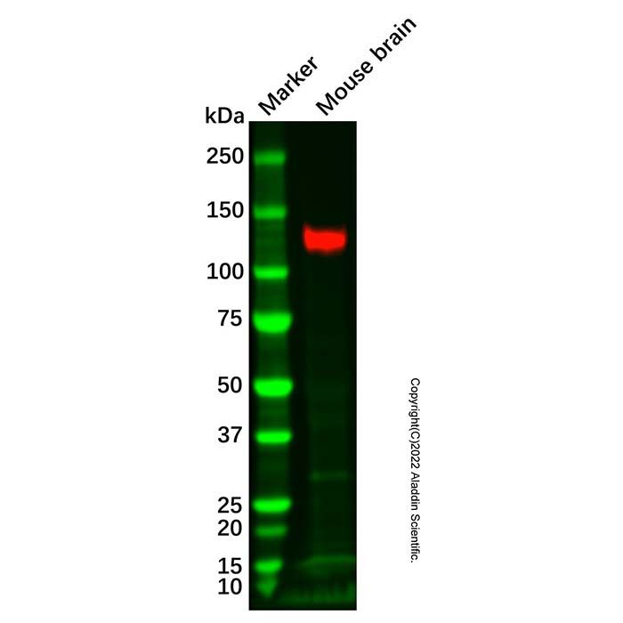 Recombinant KA1 Antibody