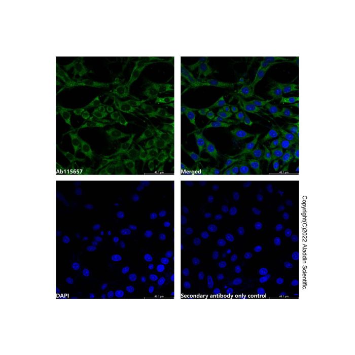 MMP2 Mouse mAb