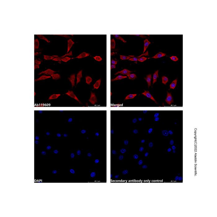 Recombinant p18 INK4c/CDKN2C Antibody