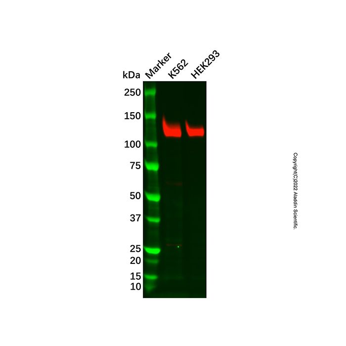 Recombinant PARP1 Antibody