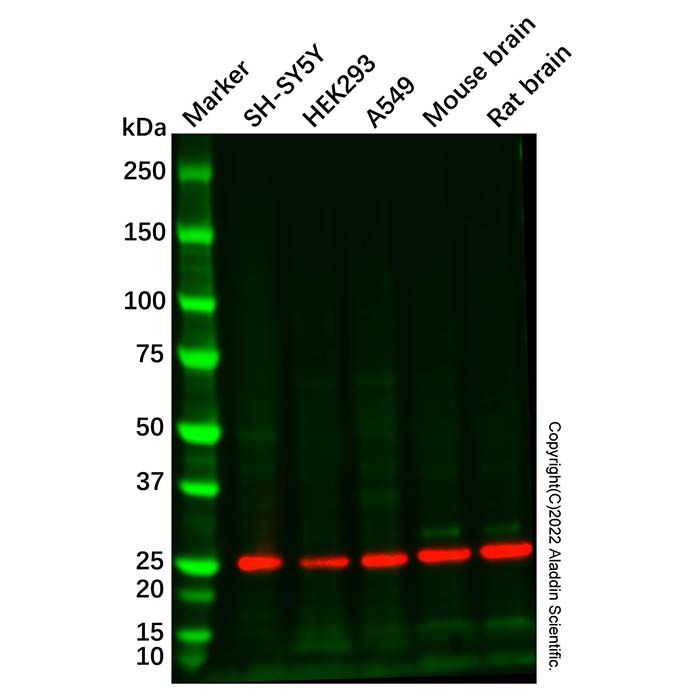 Recombinant PGP9.5 Antibody