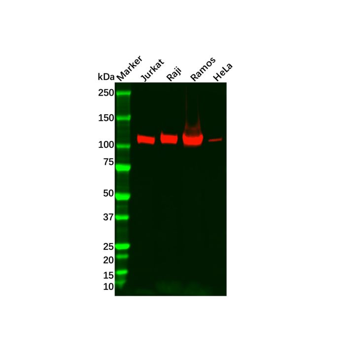 Recombinant PYK2 Antibody