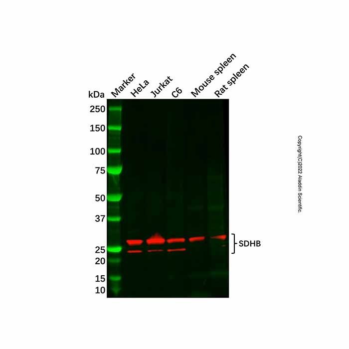 Recombinant SDHB Antibody