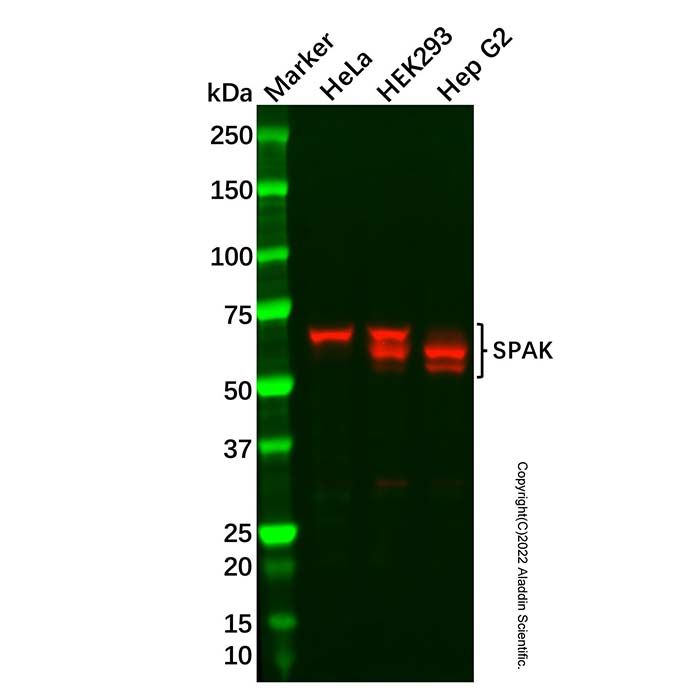 Recombinant SPAK Antibody
