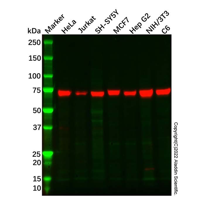 Recombinant TAK1 Antibody