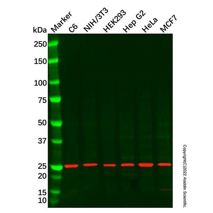 TIGAR Antibody