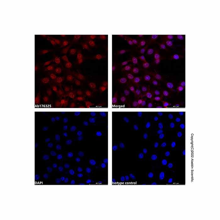 PCNA Mouse mAb (TRITC)