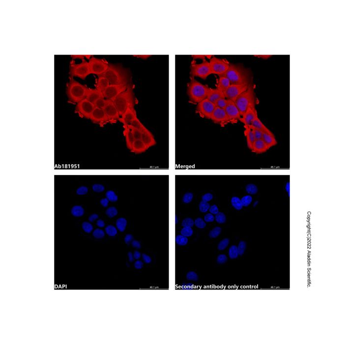 Goat Anti-Mouse IgG H&L (AF594)