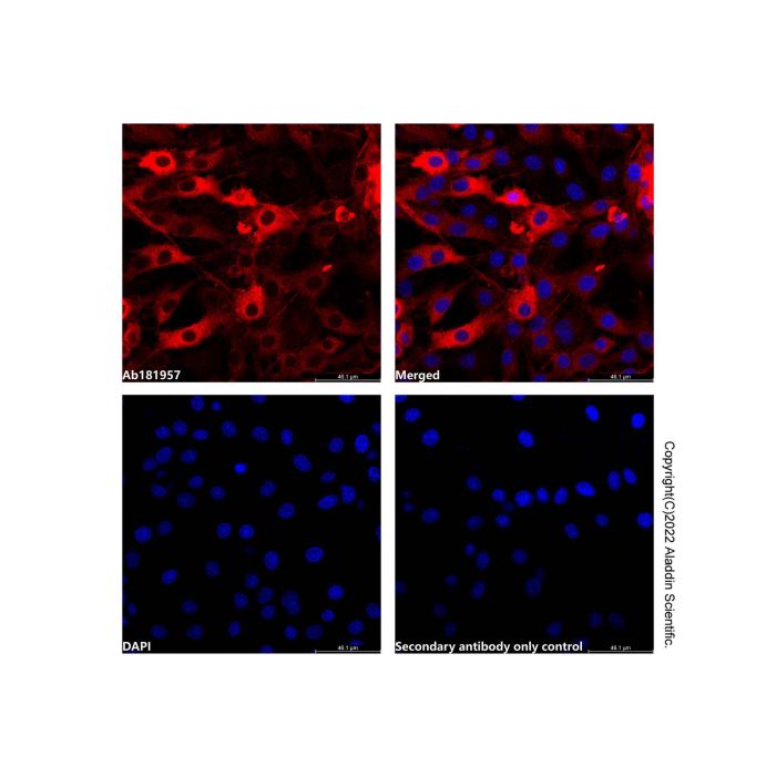 Goat Anti-Rabbit IgG H&L (AF594)