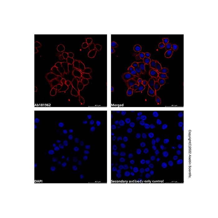 Goat Anti-Human IgG (AF594)