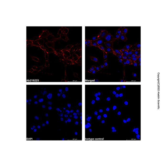 alpha-Smooth Muscle Actin Mouse mAb (Cy5)