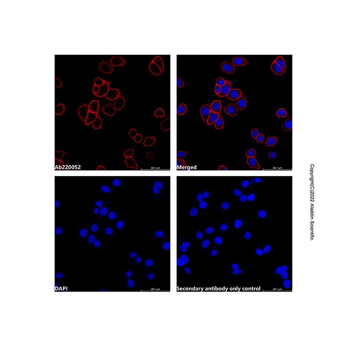Goat Anti-Rabbit IgG H&L (TRITC) (Ready to use)