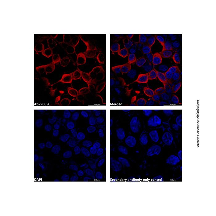 Goat Anti-Rabbit IgG H&L (AF594) (Ready to use)