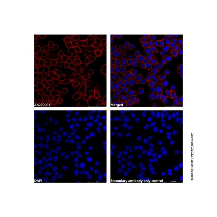 Goat Anti-Human IgG (TRITC) (Ready to use)
