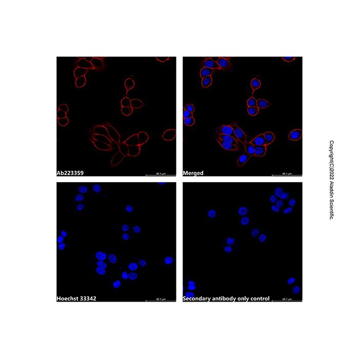 Goat Anti-Mouse IgG H&L (AF594)