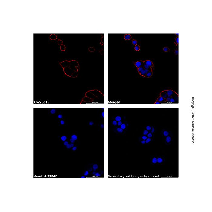 Goat Anti-Mouse IgG H&L (AF594) (Ready to use)