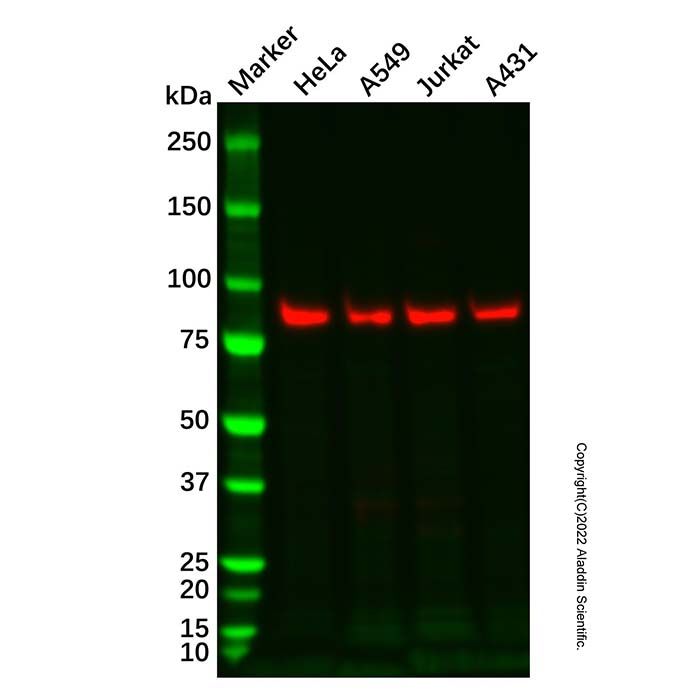 Recombinant MLH1 Antibody