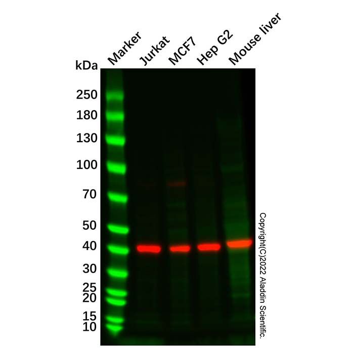 Recombinant HMBS/PBGD Antibody