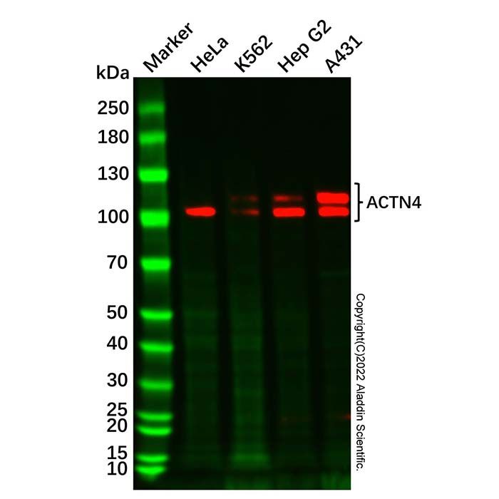 Recombinant ACTN4 Antibody