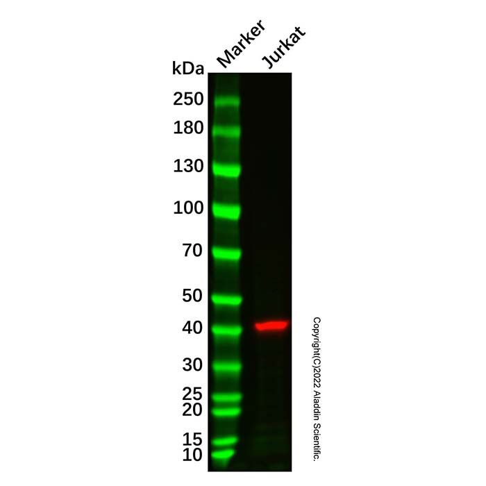 Recombinant CAPG Antibody