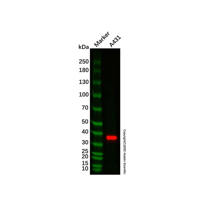 Recombinant AMPK beta 1 Antibody