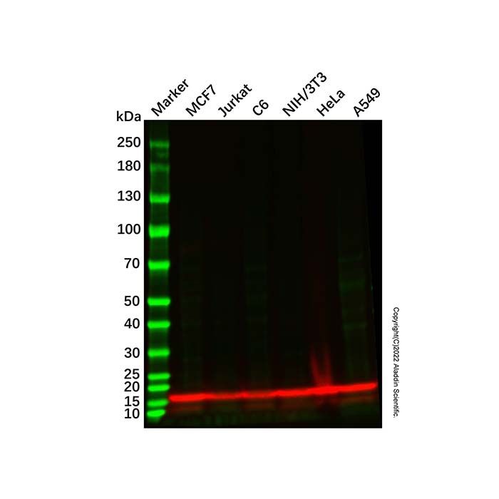 Recombinant RPS19 Antibody