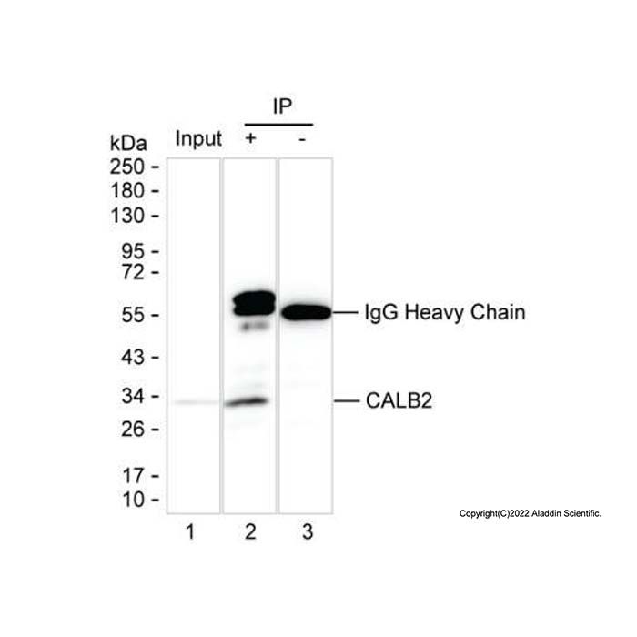 Calretinin Mouse mAb