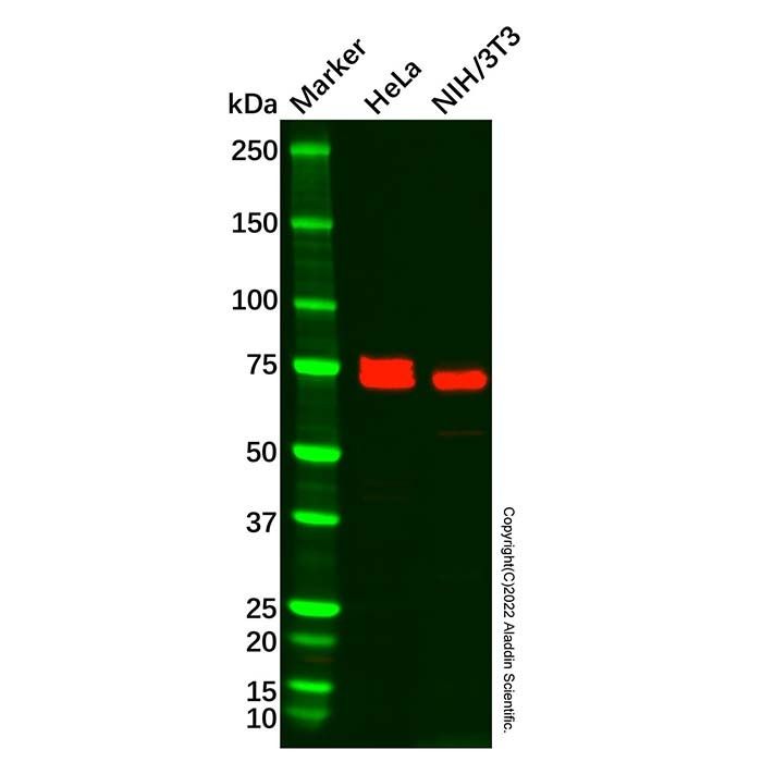 Carcino Embryonic Antigen CEA Antibody