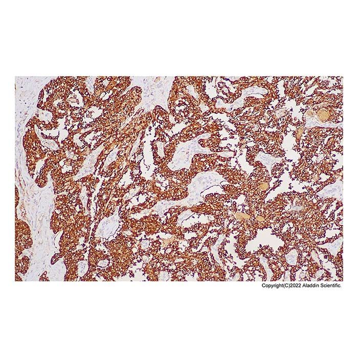 Recombinant Calcitonin Antibody