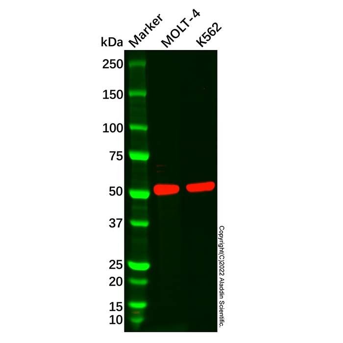 CD1a Mouse mAb