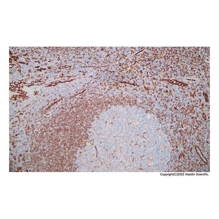 Recombinant CD31 Antibody
