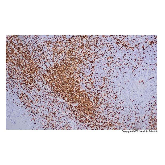 Recombinant CD7 Antibody