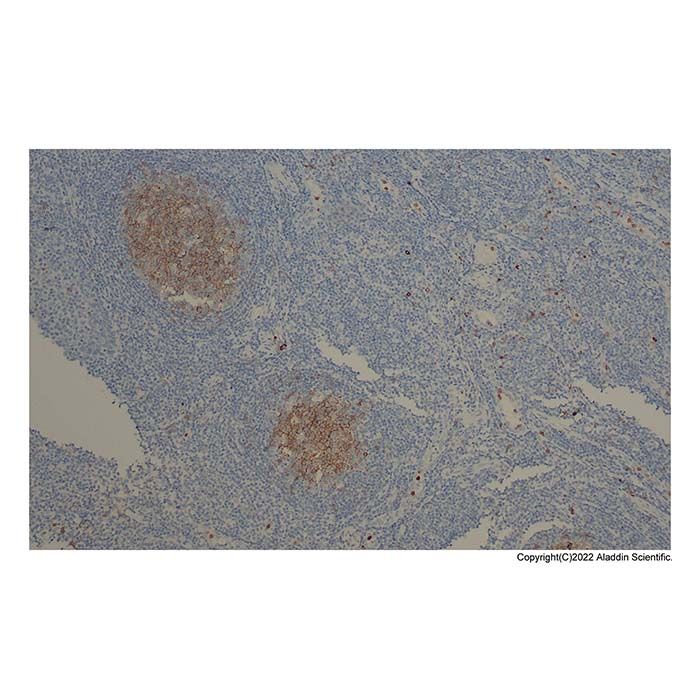 Recombinant CD10 Antibody