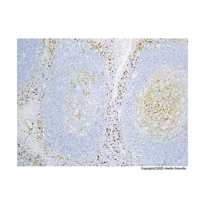Recombinant CD14 Antibody