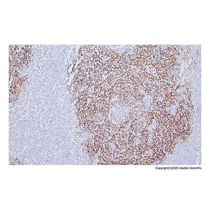 Recombinant CD21 Antibody