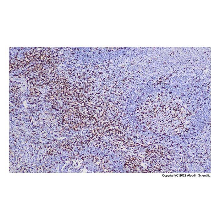 Recombinant CD45RO Antibody